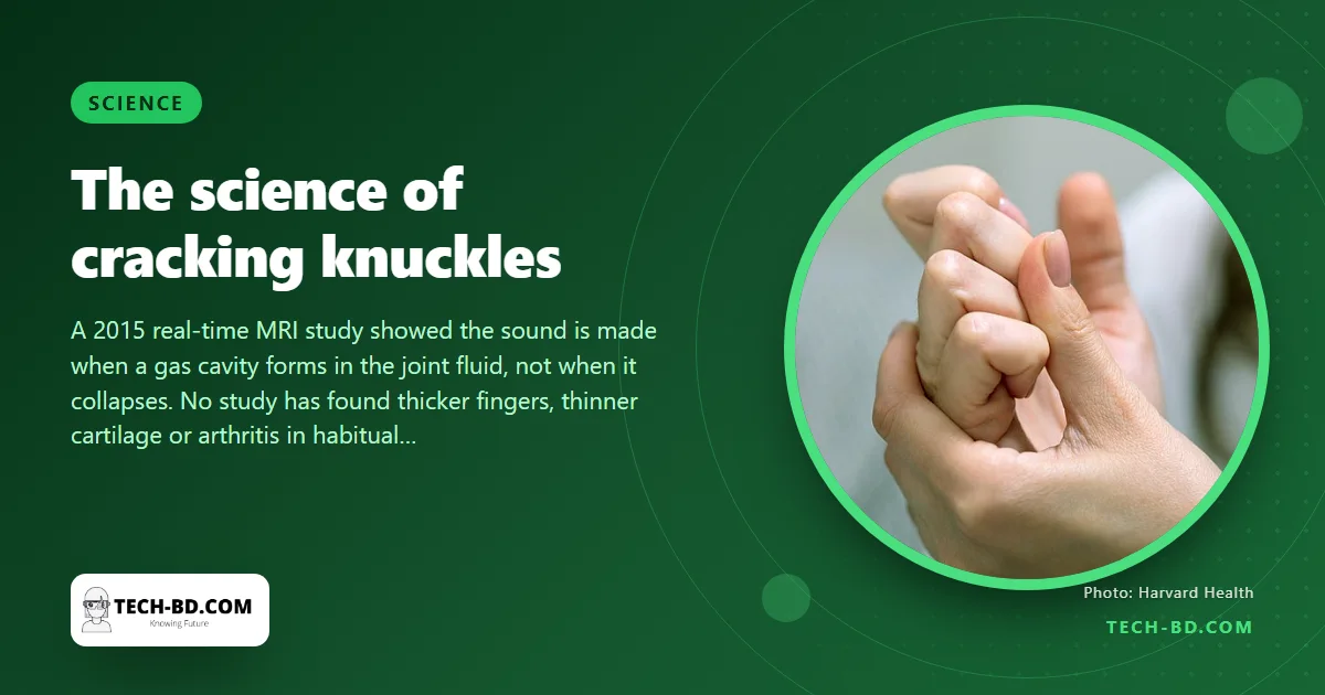 Why your knuckles pop — the MRI that settled it, and the man who cracked one hand for 50 years to prove it does no harm