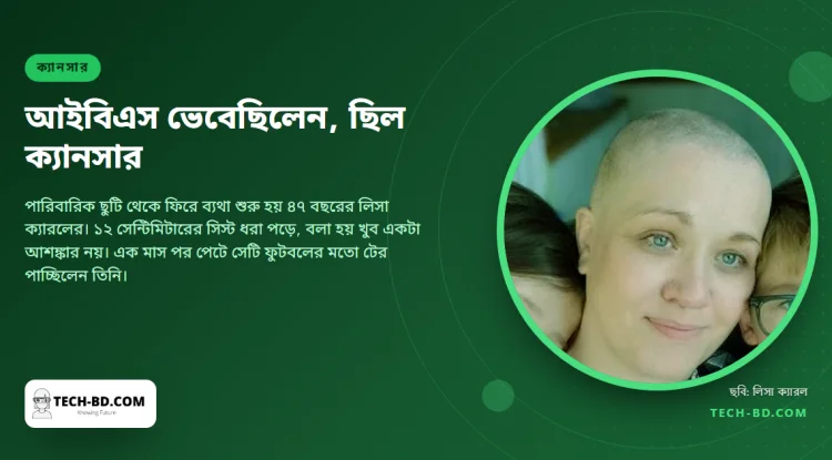 ভেবেছিলেন আইবিএস, ছিল বিরল ডিম্বাশয়ের ক্যানসার—এক মাসেই সিস্ট হলো ফুটবলের আকার