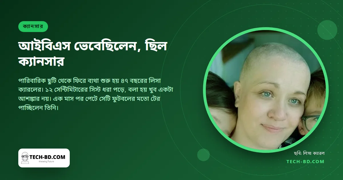 ভেবেছিলেন আইবিএস, ছিল বিরল ডিম্বাশয়ের ক্যানসার—এক মাসেই সিস্ট হলো ফুটবলের আকার