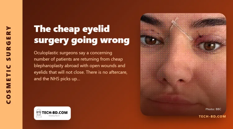 Eyes that cannot close: surgeons warn about cheap eyelid surgery bought abroad