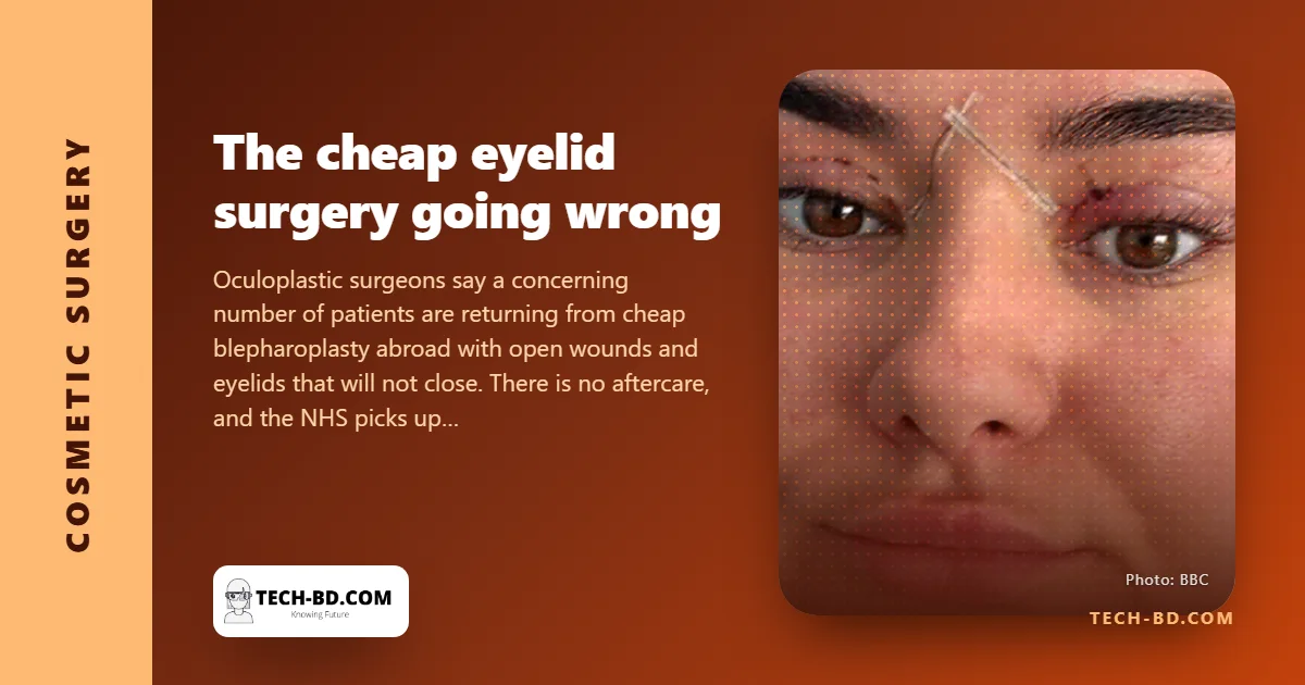 Eyes that cannot close: surgeons warn about cheap eyelid surgery bought abroad