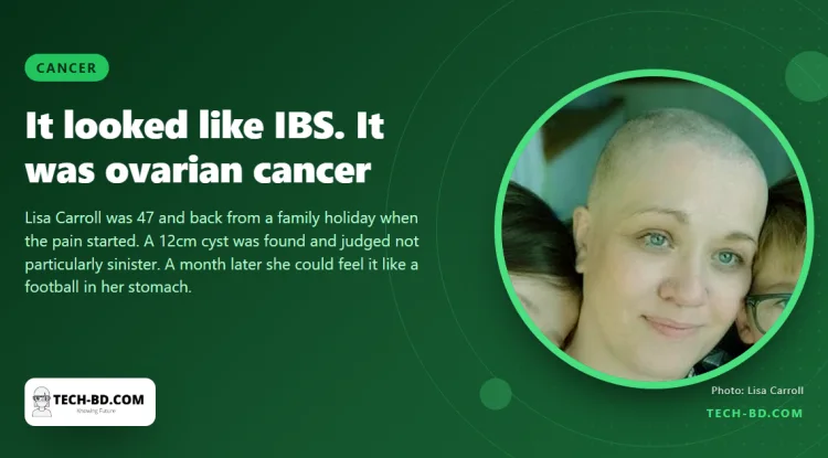 She thought it was IBS. It was a rare ovarian cancer, and within a month the cyst was the size of a football